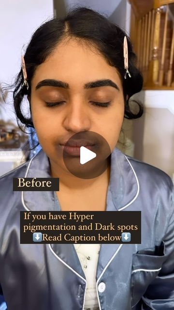 ATLANTA MAKEUP ARTIST & HAIR | SHAZMIN on Instagram: "“Hey, girlies! 🌟 When dealing with dark spots, hyperpigmentation, and dark circles, especially when you’re DIY glamming up for special occasions, follow these steps:

1. Start by hydrating dry spots with a rich, creamy moisturizer wait let it sink in and go in with your primer.
2. Apply  an orange color corrector matching the darkness of the spot. (The darker the spot- the darker the orange corrector)
3. Follow up with full-coverage foundation, possibly layering for better coverage.
4. Set your makeup with translucent powder and setting spray for that flawless finish! 💄✨”

Follow the same thing for dark circles but go in with your lighter shade of concealer after the foundation.
.
.
SAVE THIS REEL FOR LATER ✅
FOLLOW FOR MORE ✅
Dm me i Atlanta Makeup, Orange Color Corrector, Full Coverage Foundation, Translucent Powder, Color Corrector, Setting Spray, Sink In, The Darkness, The Spot