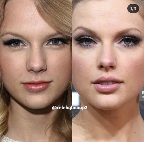 Celebrity Before And After, Taylor Swift Before And After, Celebrity Before And After Surgery, Taylor Swift Nose Job, Celebrities Before And After Surgery, Sea Before And After Surgery, Canthoplasty Before And After, Nose Plastic Surgery Before After, Before And After Plastic Surgeries