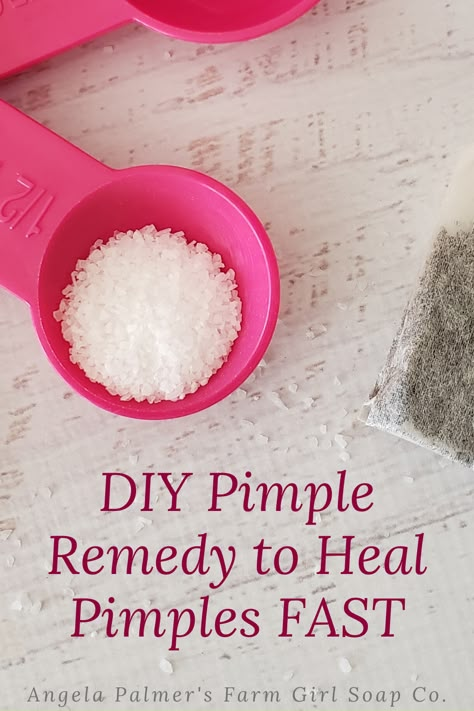 Pimple Remedies Fast, Hide Pimples With Makeup, Tips For Pimples, Pimples Skin Care, How To Hide Pimples, Mask For Pimples, Pimple Remedies, Zit Remedy, Remedies For Pimples