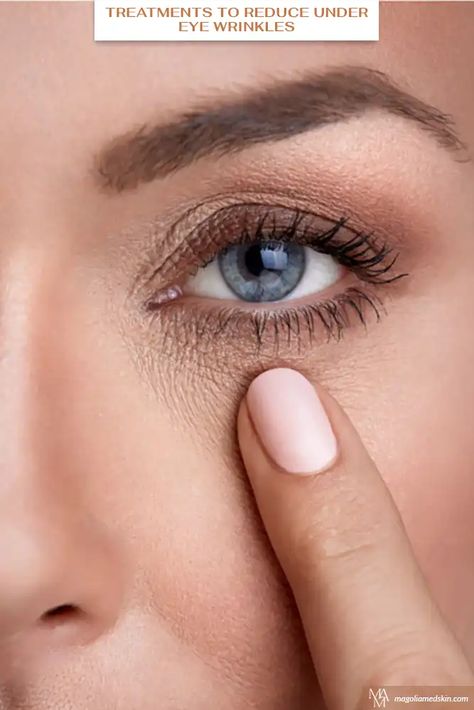 Treatments To Reduce Under Eye Wrinkles via @magnoliamedicalaesthetics Under Eye Care Tips, Undereye Bags Aesthetic, Under Eye Wrinkles Exercise, Stop Under Eye Creasing, Avoid Under Eye Creasing, Under Eye Wrinkles, Eye Wrinkle, Medical Aesthetic, Skin Care Treatments