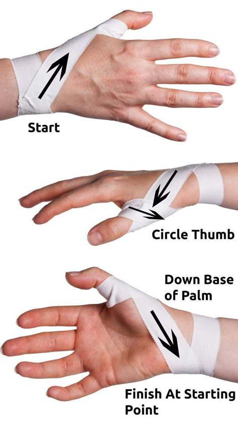 Thumb Spica Taping Step 2 | Physical Sports First Aid Athletic Training Sports Medicine, K Tape, Kt Tape, Kinesio Taping, Sports Therapy, Volleyball Workouts, Kinesiology Taping, Trening Fitness, Hand Therapy