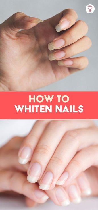 How To Whiten Nails, Strong Nails Diy, Make Nails White, Nails Remedies, Diy Nail Care, Natural Nail Tips, Nail Remedies, Nail Whitening, Nail Growth Tips