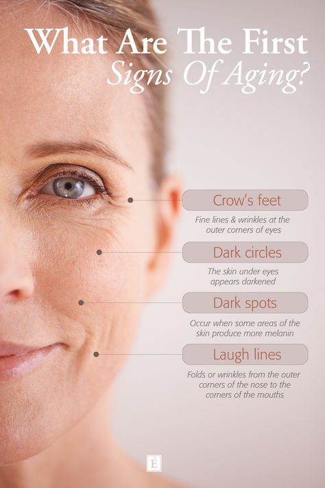 Graphic featuring woman's face showing the signs of aging skin Skincare Infographic Design, Botox Infographic, Medspa Posts, Beauty Infographic, Skincare Facts, Skin Facts, Eminence Organic Skin Care, Green Tea Face, Skin Care Business