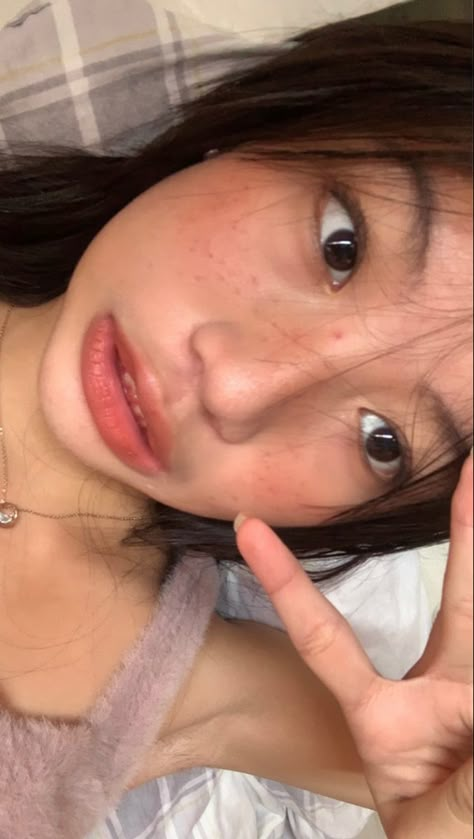 Basic Asian Makeup, Asian Freckles Makeup, Makeup Tutorial Freckles, Beabadoobee Without Makeup, Cute Freckles Makeup, Beabadoobee Freckles, Natural Makeup With Acne, Fake Freckles Makeup Tutorials, Natural Freckles Makeup