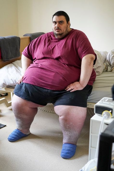 BRITAIN’S fattest man wants a gastric bypass for Christmas – after piling on most of the weight he lost over the past year. Super-morbidly obese Jason Holton was last seen being winched from his old, third-floor flat by crane in 2020 after he ballooned to a terrifying 50st. Jason, 31, managed to lose 10st in […] Whale Costume, Messi Pictures, Chubby Men, Shock And Awe, Disney Princess Movies, Gastric Bypass, Last Man, Fat Man, Disney Princess Art