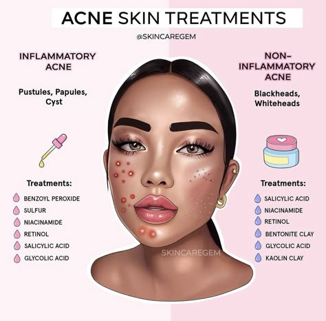 Haut Routine, Skin Advice, Skin Care Routine Order, Clear Healthy Skin, Basic Skin Care, Basic Skin Care Routine, Acne Treatments, Perfect Skin Care Routine, Acne Solutions