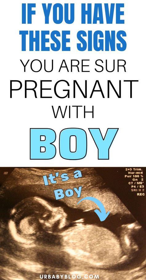 Are you wondering if you're having a girl or a boy? Your body does react different when you're pregnant with a girl vs a boy. Learn what the signs of a boy are. Signs Your Pregnant, Boy Vs Girl Pregnancy, Boy Or Girl Prediction, Signs You Are Pregnant, Pregnancy Gender Prediction, Phonics Reading Activities, Boy Or Girl Sign, Gender Chart, Baby Boy Signs