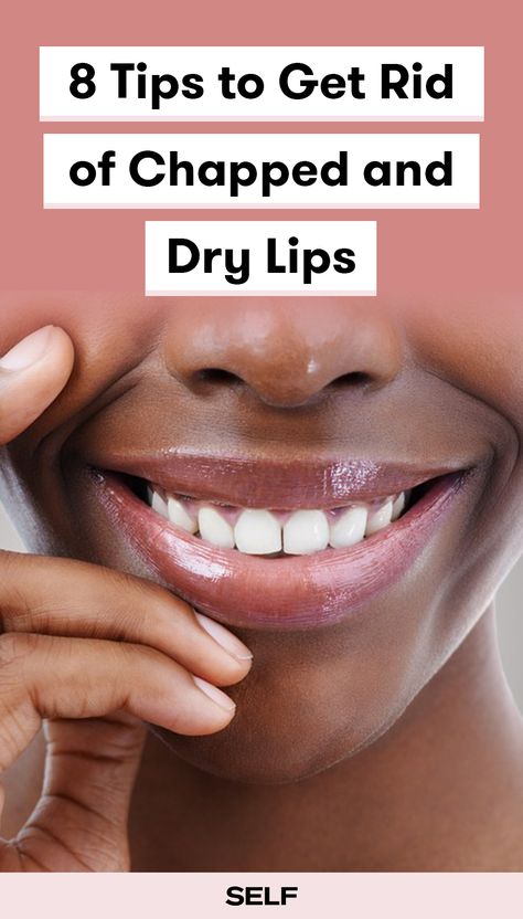 Looking for a severe chapped lips remedy as the weather gets colder? These simple products will help dry lips stay moisturized. Severely Chapped Lips Remedy, Peeling Lips Remedies, Dry Chapped Lips Remedy, Chap Lips Remedy, Remedy For Dry Lips, Natural Lip Moisturizer, Heal Chapped Lips Fast, How To Help Dry Lips, Severe Chapped Lips