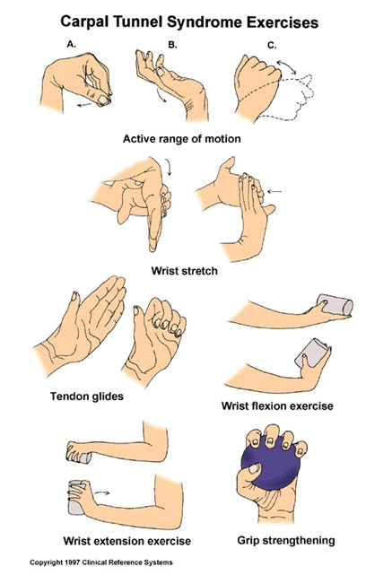 Carpal Tunnel Relief Exercises, Carpal Tunnel Remedies, Hand Therapy Exercises, Carpal Tunnel Exercises, Carpal Tunnel Surgery, Carpal Tunnel Relief, Carpel Tunnel, Wrist Exercises, Therapy Exercises