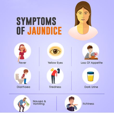 If you facing the problems such as fever , yellow eyes ,diarrhoea , tiredness , itchiness etc this all are various symptoms of Jaundice. For the solution of this you need to consult your doctor or to take care of this with the help of Hashmi's Jaundinil Capsule. #ayurveda #hashmi Jaundice Symptoms, Bilirubin Levels, Liver Function Test, Blood Disorders, Pathology Lab, Prioritize Your Health, Med School Motivation, Healthy Food Menu, Liver Function