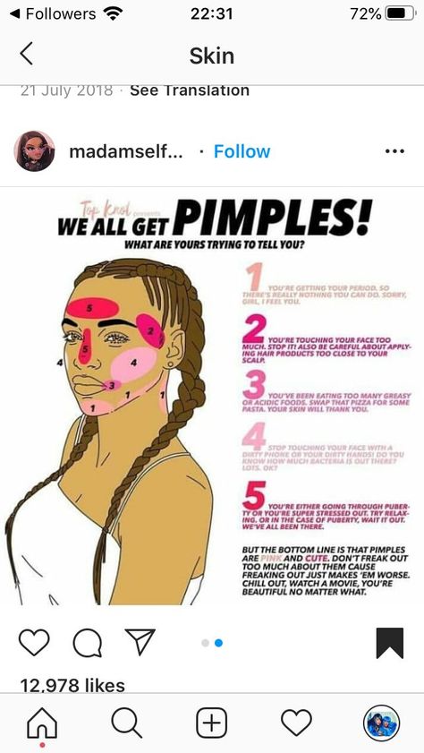 Please Re-Pin for later 😍💞 Revitalize Your Skin - Click Here! 💯 pimples in pubic area, pimples in nose lupus, eczema on face steroid cream 👍 #selfcare #toner #dryskin What Pimples In Different Places Means, What Ur Pimples Mean, How To Get Rod Of Pimples Fast At Home, Where Your Pimples Are And What It Means, Pimple Area Meaning, Pimple Chart, Pimple Meaning, Pimples Skin Care, Bumps On Face