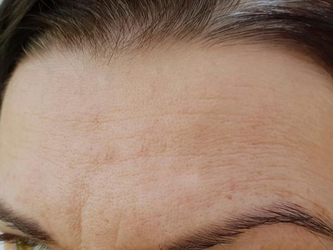 Forehead Wrinkles Remedies, Remove Forehead Wrinkles, Get Rid Of Forehead Wrinkles, Reduce Forehead Wrinkles, Best Skincare Brands, Facial Massage Techniques, Take Good Care Of Yourself, Facial Tips, Wrinkle Remedies