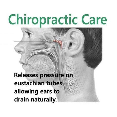 Tired of your little ones getting ear infections? Chiropractic can help! We love caring for your little ones Stop in today or tomorrow 9-1 and 3-6! Walk-ins are always welcome!! https://www.instagram.com/p/B5GOfISJOmc/ via www.tarnickchiropracticandacupuncture.com Chiropractic Benefits, Chiropractic Quotes, Chiropractic Marketing, Benefits Of Chiropractic Care, Family Chiropractic, Ear Infections, Chiropractic Wellness, Chiropractic Adjustment, Chiropractic Care