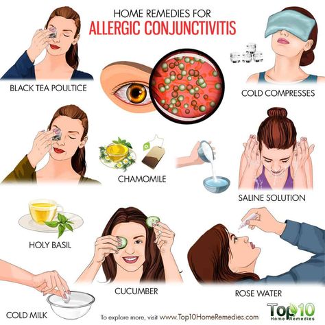 Home Remedies for Allergic Conjunctivitis | Top 10 Home Remedies Pinkeye Remedies, Allergy Eyes, Home Remedies For Allergies, Natural Remedies For Allergies, Top 10 Home Remedies, Sick Remedies, Allergy Remedies, Itchy Eyes, Pink Eye