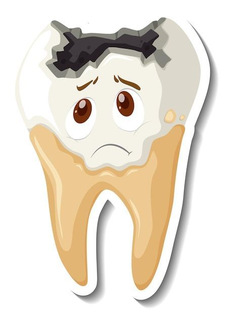 Tooth Decay Cartoon, Decayed Tooth, Tooth Caries, Teeth Decay, Cartoon Teeth, Teeth Illustration, Tooth Cartoon, Teeth Drawing, Dental Decay