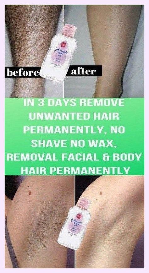 I’m so grateful I get to be here. Laudable info! Best Permanent Hair Removal, Best Hair Removal, Electrolysis Hair Removal, Hair Removal Spray, Unwanted Hair Permanently, Best Hair Removal Products, Remove Unwanted Facial Hair, Underarm Hair Removal, Remove Unwanted Hair