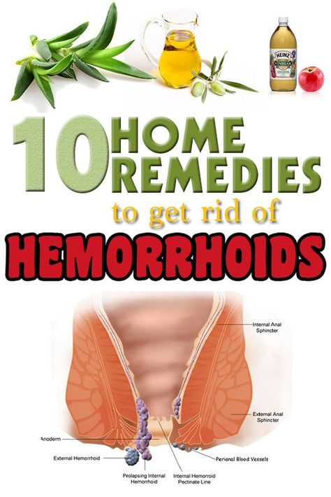 Hemorrhoid Remedies, Natural Home Remedies, Blood Vessels, Health Remedies, Herbal Remedies, Natural Healing, Natural Health, Health Wellness, Home Remedies