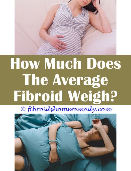 Fibroid Weight Chart: A Visual Reference of Charts | Chart Master