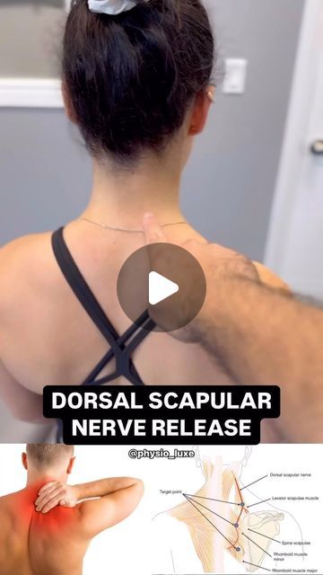 Knots In Neck Muscle, Pinched Nerve In Shoulder, Pinched Nerve In Neck, Shoulder Blade Muscles, Levator Scapulae, Shoulder Muscle Pain, Nerve Pain Remedies, Nerve Anatomy, Neck And Shoulder Exercises