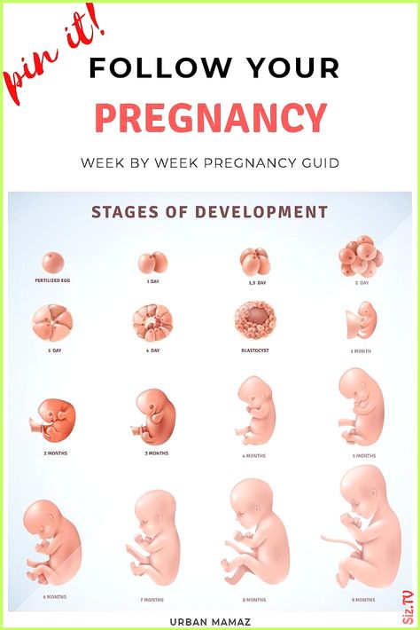 Guide to week by week of pregnancy &; PREGNANCY PHASES Guide to pregnancy week by week &; ..., #5montholdbabydevelopement #amp #babydevelopementactivities #babydevelopementbrain #babydevelopementbyweek #babydevelopementchart #babydevelopementfirstyear #babydevelopementinwomb #babydevelopementmilestones #babydevelopementstages #babydevelopementtoys #Guide #Phases #pregnancy #week Check more at... Pregnancy Symptoms By Week, Baby Development In Womb, Body Changes During Pregnancy, Stages Of Baby Development, Trimester By Weeks, Baby Development Activities, 20 Weeks Pregnant, Pregnancy Week, Pregnancy Info