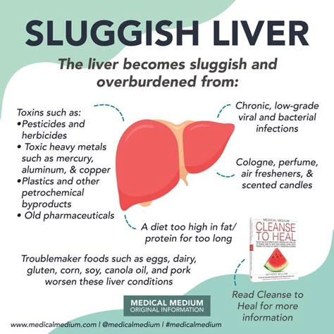 Sluggish Liver Medical Medium Heavy Metal Cleanse, Sluggish Liver, Medical Medium Liver Cleanse, Liver Rescue, Symptoms Of Liver Issues, Mm Recipes, Celiac Symptoms, Quadrants Of The Abdomen, Health Posts