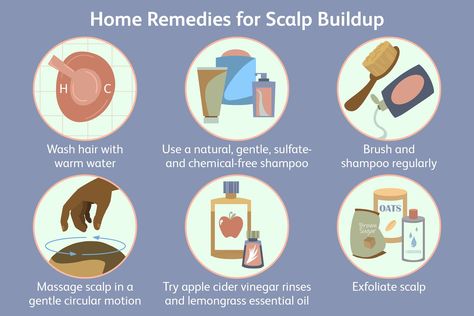 Sebum Buildup On Scalp, Seborrheic Dermitis On Scalp, Itchy Scalp Remedy, Scalp Remedies, Crusty Skin, Sores On Scalp, Apple Cider Vinegar Hair Rinse, Home Remedies For Dandruff, Scalp Cleanse