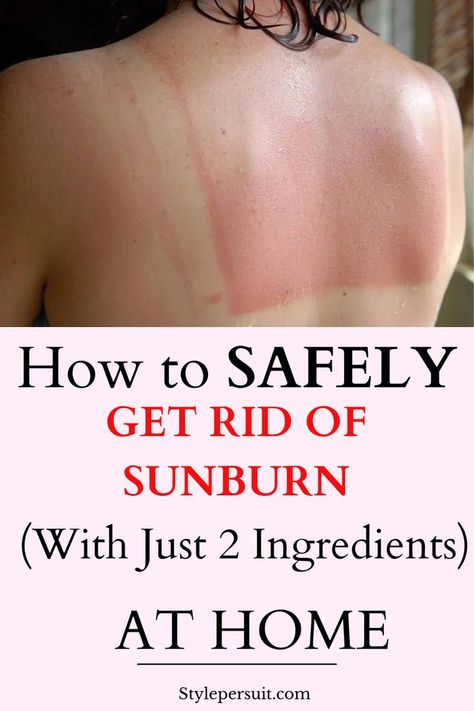 Sunburn, the painful result of overexposure to ultraviolet (UV) rays from the sun, is an all-too-common summertime ailment. Whether you forgot to apply sunscreen or simply spent too much time outdoors, dealing with sunburn can be uncomfortable and frustrating. While there are numerous over-the-counter remedies available, many people prefer natural alternatives to soothe their sun-damaged skin. Check out these effective methods for getting rid of sunburn naturally. ##skincare Skin Peeling From Sunburn, Best Sunburn Relief, Sunburn On Face, Sun Blisters, Sunburn Blisters, Get Rid Of Sunburn, Natural Remedies For Sunburn, Sunburn Peeling, Sunburn Remedies