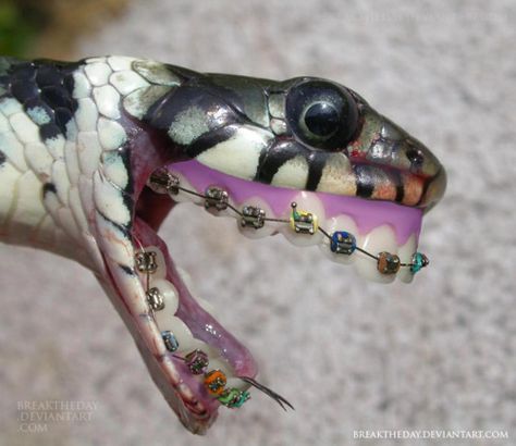 King Cobra with photoshoppped dentures layered in with braces. Clever!! Dental Humor, Clean Humor, 웃긴 사진, A Snake, 귀여운 동물, Tumblr Funny, Braces, Make You Smile, Make Me Smile