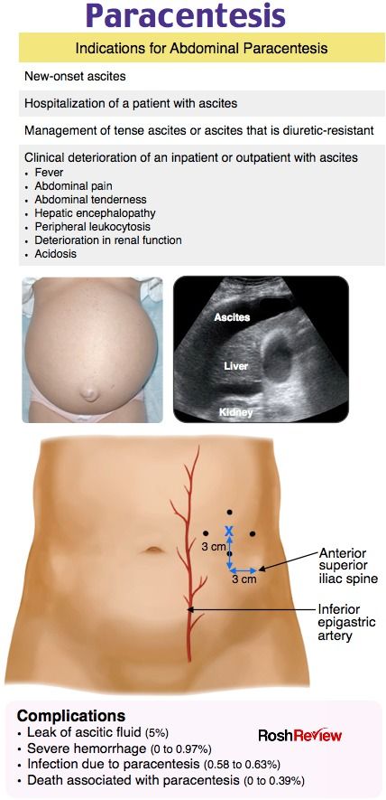 Vetenary Medicine, Medical Diagnosis, Physical Examination Medical, Rsi Medications, Medicine Mnemonics, Internal Medicine Notes, Transfusion Medicine, Nursing Information, Diagnostic Medical Sonography