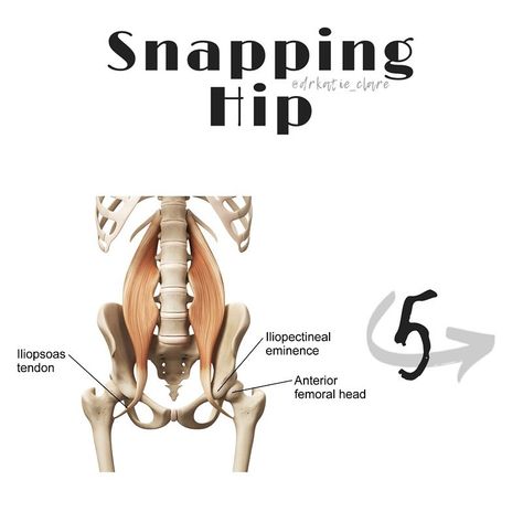 Dr. Katie Clare on Instagram: “Snapping Hip Syndrome💫 . Real talk- bodies are noooisy. Just because you're having clicking/popping does NOT automatically mean anything is…” Snapping Hip Syndrome, Just Because, Real Talk, Health, On Instagram, Instagram