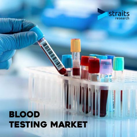 The global blood testing market was valued at USD 54.1212 billion in 2018 and is projected to reach a value of USD 67.50 billion by 2026, registering a CAGR of 6.10% during the forecast period, 2019–2026. Primary Research, Air Conditioning Services, Blood Test, News Agency, Share Market, Health Services, 15 Minutes, Disease, Passenger