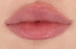 Non Cupids Bow Lips, Lips No Cupid, Round Lip Filler Shape, Round Cupids Bow Lips Aesthetic, Upturned Lips Corners, Bambi Lips, Lip Claims For Dr, Round Lips Aesthetic, Round Top Lip