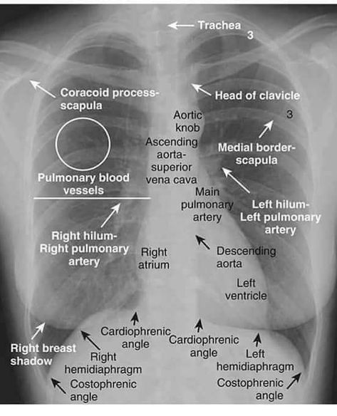 Medical Radiography, Radiology Student, Radiology Imaging, Medical Pictures, Medical Student Study, Pulmonology, Medical School Studying, Medical School Essentials, Human Anatomy And Physiology