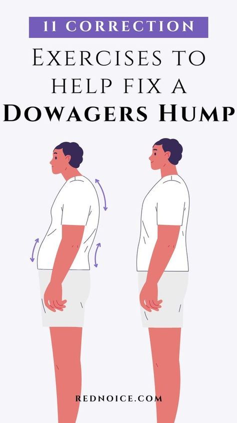 Improve your posture and minimize that dowager's hump with 11 stretches and exercises focused on correction and prevention. By strengthening your upper back while gently mobilizing tight areas around your neck and shoulders, these daily routines can help you achieve better alignment and reduce rounding in your upper back. Make these moves part of your regimen to get rid of that hump for good! Improve Posture Exercises, Dowagers Hump, Neck Posture, Dowager's Hump, Posture Stretches, Forward Head Posture Exercises, Better Posture Exercises, Posture Correction Exercises, Neck And Shoulder Exercises