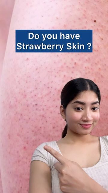 Ria Amin | Content Creator on Instagram: "Dealing with Strawberry Skin problems?🤔 AHA BHA Body Pack by @be.bodywise🤩 is the best combination to deal with that! This Kit comprises 1% Salicylic Acid Bodywash, a BHA that unclogs pores and cleanses our pores. And the second one is the 5% Lactic Acid Body Lotion, an AHA that not only exfoliates but also helps in new cell regeneration resulting in nourished skin. 👉 With my code RIABW10 💙 get ✨️10%✨️ off on this AHA BHA kit. Two of the main active Lotion For Strawberry Skin, For Strawberry Skin, Strawberry Skin, Aha And Bha, Strawberry Legs, Aha Bha, Cell Regeneration, Skin Essentials, Unclog Pores