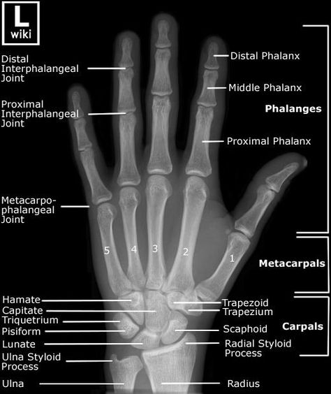 Embedded Anatomi Dan Fisiologi, Radiography Student, Radiology Schools, Medical Radiography, Radiology Student, Radiology Technician, Radiology Imaging, Radiology Tech, Medical School Studying