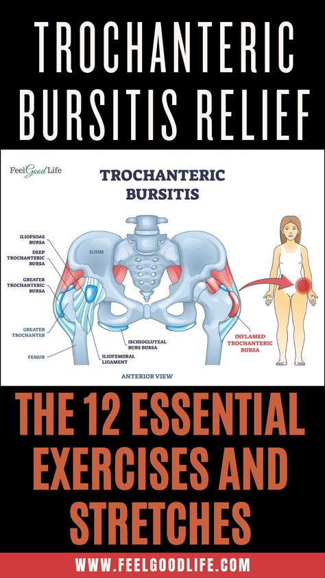 Bursitis Hip Relief, Best Exercise For Hips, Hip Strengthening Exercises, Hip Flexor Exercises, Bursitis Hip, Hip Pain Relief, Sciatica Exercises, Lower Back Pain Exercises, Sciatic Nerve Pain