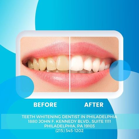 If you live in Philadelphia, you can benefit from a teeth whitening procedure at our dental office. We are known for improving the appearance of our patients' smiles. To make an appointment contact us (215) 545-1202. //dentist//dental//dentistry// #philadelphia #teethwhitening Dentist Social Media, Dentist Branding, Oral Hygiene Products, Dental Mouthguards, Teeth Whitening Dentist, Dental Doctor, Teeth Whitening Methods, Teeth Whitening Procedure, Festival Banner