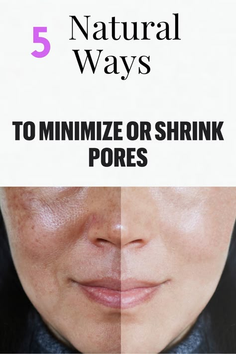 Make Pores Smaller, Nails Remedies, Diy Nail Care, Best Moisturizer For Oily Skin, Big Pores, Dry Oily Skin, Lotion For Oily Skin, Nose Pores, Face Pores