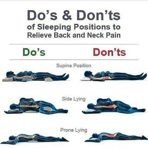 The Do's and Don't of sleeping positions to relieve back and neck pain . . . . #healthylifestyle #healthyliving #healthylife #healthychoices #healthyhabits #healthybody #healthychoice #healthychoicesmatter Sleep Posture, Sleep Positions, Sciatica Pain Relief, Lower Back Pain Exercises, Ways To Sleep, Lower Back Pain Relief, Sciatica Pain, Sleep Health, Sciatic Nerve