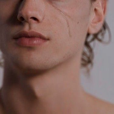 Lucien Vanserra, Frost And Starlight, Eye Scar, Facial Scars, Court Of Mist And Fury, Luke Castellan, Silver Flames, Rid Of Blackheads, Acotar Series