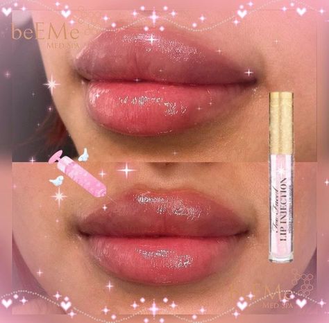 STRAWBERRIEKISSES♡ on Twitter: "https://t.co/wCsarZqLjd" / Twitter Brats Doll Lip Filler, Bratz Lip Filler, Bratz Doll Lip Filler, Doll Lips Filler, Round Lips Filler, Bratz Doll Lips, Bratz Lips, Fairy Eyes, Bratz Doll Makeup