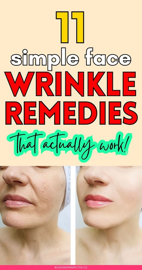 Ready to say goodbye to fine lines? These 11 diy wrinkles remedies will help you prevent wrinkles and keep your skin looking fresh! From home remedies for wrinkles to oils and massages, we’ve got all the wrinkle remedies face tricks you need. Check out the blog for the best anti aging tips and maintain your wrinkles skin care routine effortlessly! Remedies For Wrinkles On Face, Face Exercises For Wrinkles Anti Aging, Skin Care Routine For Wrinkles, Makeup With Wrinkles, Face Skin Tightening Home Remedies, Younger Skin Anti Aging, Creepy Skin Remedies, Natural Botox For Face Wrinkles, Natural Remedies For Wrinkles