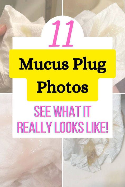 Many first time parents wonder what a mucus plug really looks like during pregnancy and right before labor. If you're a new mom and curious, here are 11 photos of mucus plugs that show different colors, sizes, and shapes. Learn the difference between what a mucus plug and bloody show looks like and how much mucus plug is normal before going into labor and during labor. Click through for all the details and photos! Mucus Plug Signs Labor, Belly Mapping Pregnancy, Ways To Go Into Labor Faster, Mucus Plug Look Like, 1st Month Of Pregnancy, Mucous Plug, Holistic Motherhood, Holistic Pregnancy, Labor Photos