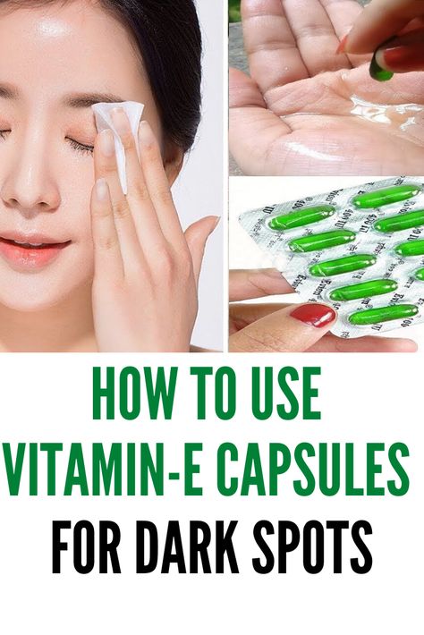 Vitamin E oil is derived from vitamin E, and you can directly apply it on your skin, can consume it, or even apply it on your hair. Many companies make vitamin E supplements and also products that contain vitamin E. So, let us have a look at some of the benefits of vitamin e capsules and uses. #darkspots #face #vitamine Use Of Vitamin E Capsule For Face, Beautiful Tips For Face, Vitamin E Benefits For Skin, Uses Of Vitamin E Capsules For Skin, Vitamin E Capsules For Face How To Use Vitamin E Capsules For Face, Vitamin E Capsules For Face Overnight, Vitamin E On Face, How To Use Vitamin E Capsules For Face, Vitamin E Capsules For Hair