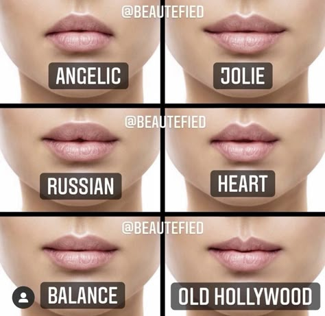 Types Of Lips Shape, Heart Shaped Lips, Lips Inspiration, Lip Types, Permanente Make-up, Face Fillers, Botox Lips, Facial Fillers, Facial Aesthetics