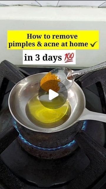 Generated Description with relevant hashtags. Pimple Remedies At Home, Pimple Remove Tips At Home, How To Prevent Pimples, Remedy For Pimples On Face, Pimples How To Get Rid Of, How To Remove Pimples At Home, How To Remove Acne, Skincare For Pimples, Pimple Remove Tips