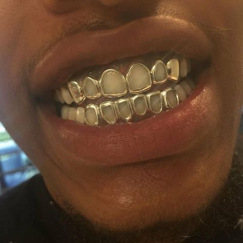 Gold Teeth Grills, Open Face Grillz, Girl Grillz, Pretty Teeth, Silver Grillz, Dental Jewelry, Grillz Teeth, Teeth Caps, Gold Grill