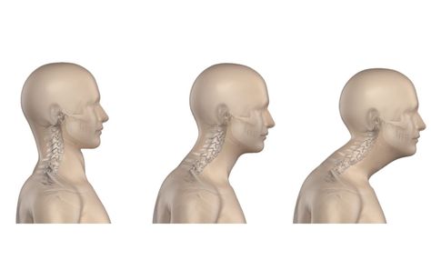 Neck Muscle Exercises, Desk Posture, Neck Headache, Neck Posture, Forward Head Posture Exercises, Muscle Exercises, Chin Tuck, Text Neck, Forward Head Posture