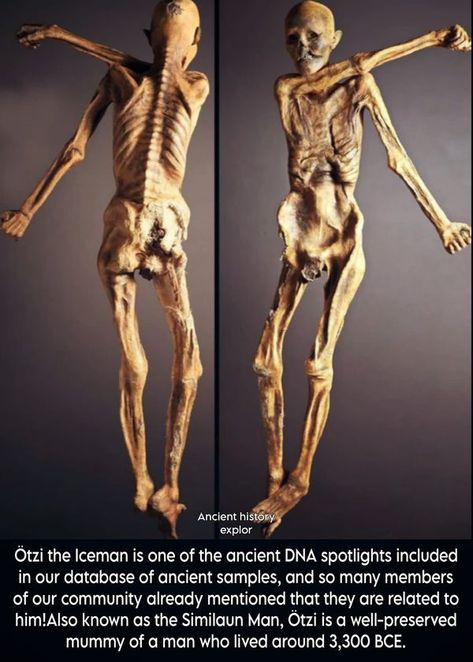 Ancient World History | Ötzi the Iceman, also known as the Similaun Man, is an extraordinarily well-preserved natural mummy dating back to around 3,300 BCE | Facebook Ötzi The Iceman, Ancient World History, The Iceman, Ancient World, World History, Archaeology, Aliens, Marvel, History